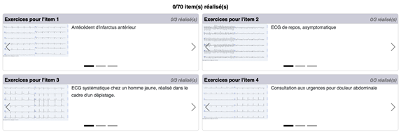 quiz ecg uness cardiologie