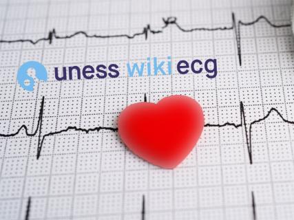 uness wiki ecg